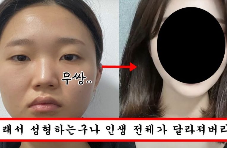 성형 하나로 얼굴 완전 바껴서 연예인 소속사까지 발벗고 나서게 한 흔한 여자의 성형 후기