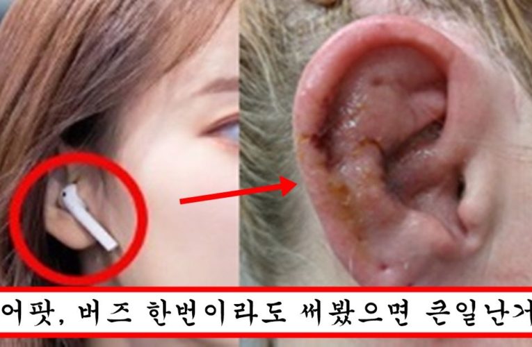 에어팟,버즈 등 무선 이어폰 쓰는 사람은 10년 뒤에 다 큰일나는 이유
