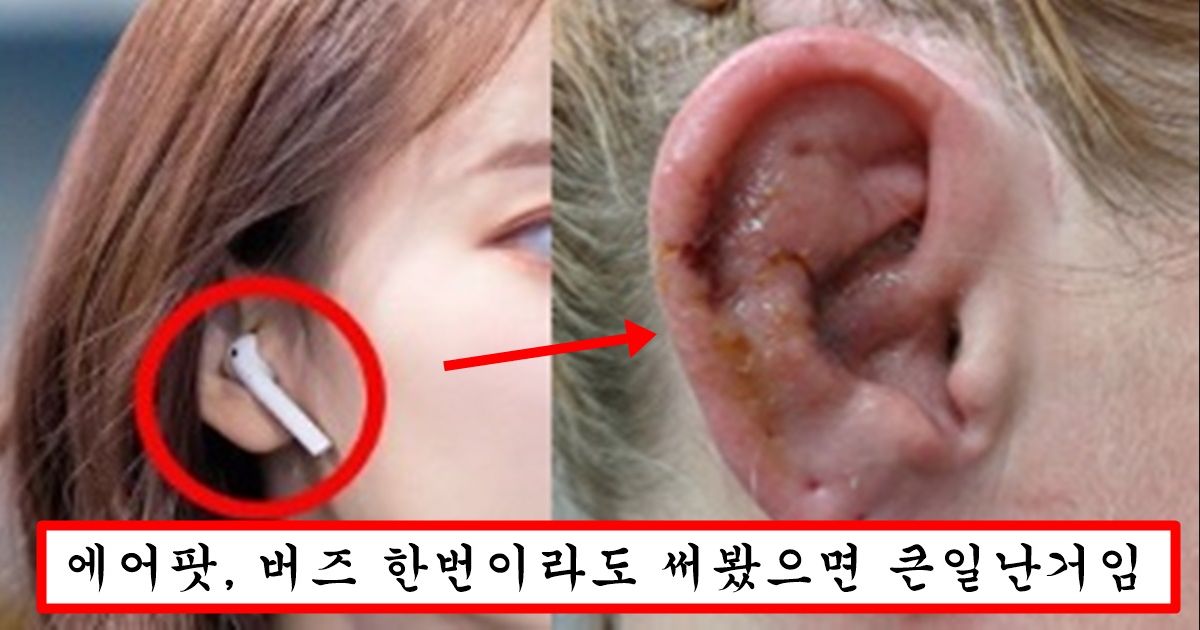에어팟,버즈 등 무선 이어폰 쓰는 사람은 10년 뒤에 다 큰일나는 이유
