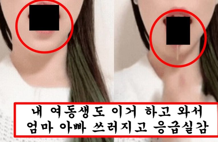 요즘 남자랑 스킨쉽할 때 유용하다며 20대초반 여자들 사이에서 유행한다는 뱀 혀 시술