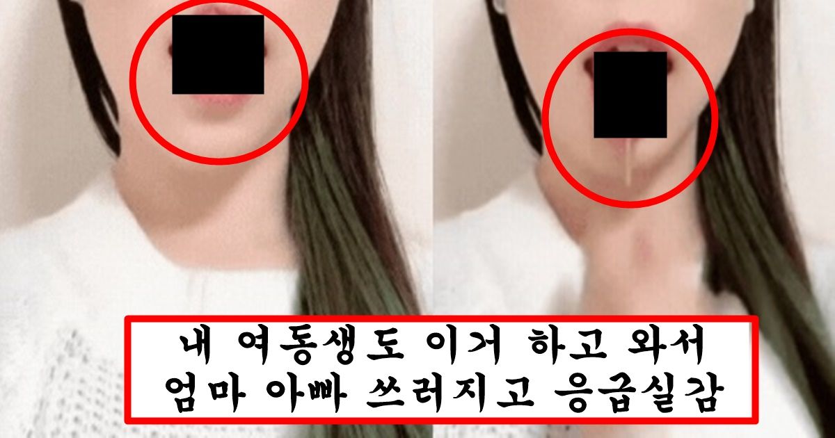 요즘 남자랑 스킨쉽할 때 유용하다며 20대초반 여자들 사이에서 유행한다는 뱀 혀 시술