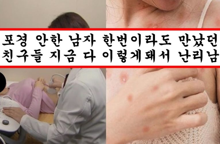 요즘 여자들이 남자 만날때 포경 안한 남자는 절대 안만나다고 하는 이유