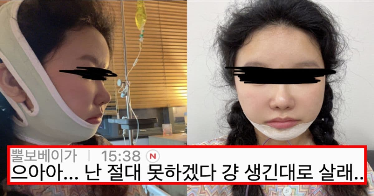 성형 여러번 해본 사람들도 너무 아파서 하다가 중간에 도망간다는 시술