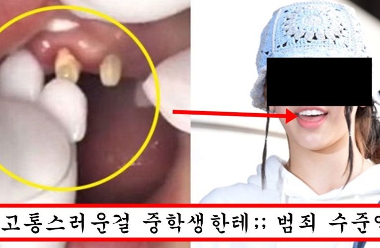 중학생 2명을 이가 누렇다는 이유로 하기 싫다는 라미네이트 강제로 시켜버린 소속사