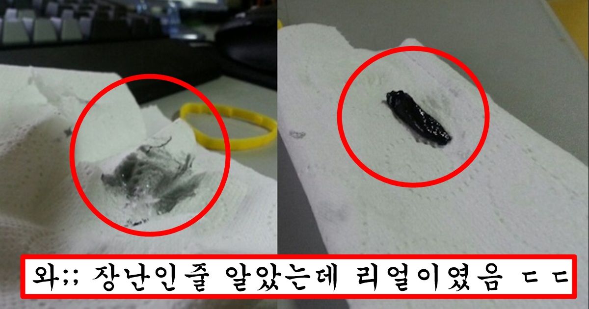정액 색깔이 이상해서 병원 갔더니 병원에서 내려준 소름돋는 진단