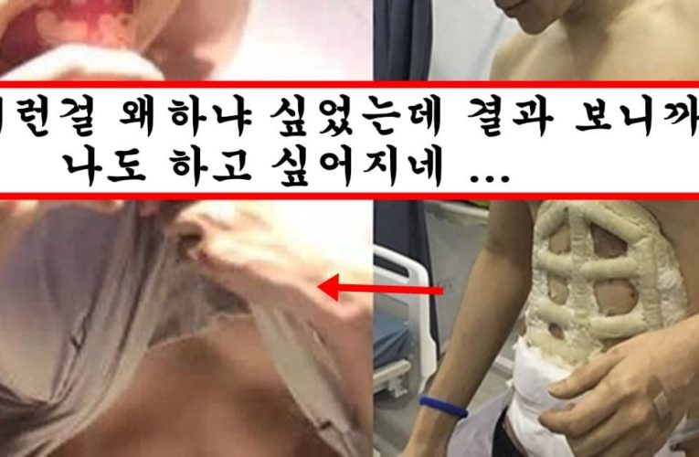 요즘 남성들 사이에서 유행 중이라는 하자마자 식스팩 만들어진다는 성형 수술의 충격 과정