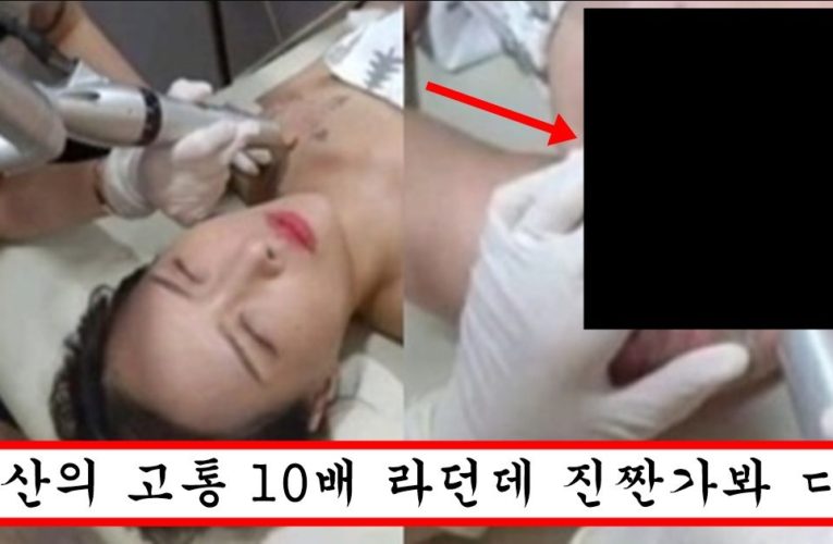 “문신 함부러 했다가는 이렇게 됩니다” 유튜버가 생중계 하다가 기절해버린 문신 지우는 장면