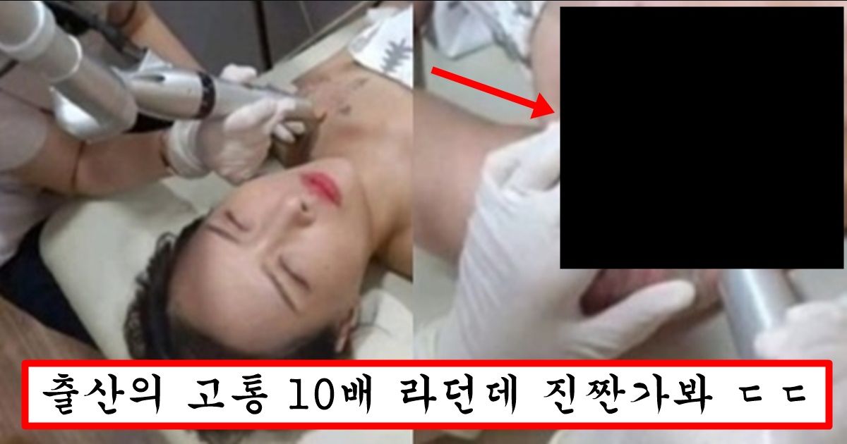 “문신 함부러 했다가는 이렇게 됩니다” 유튜버가 생중계 하다가 기절해버린 문신 지우는 장면