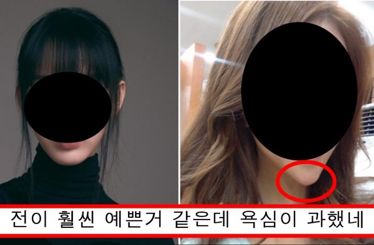 턱에 필러 너무 과하게 넣어서 징그럽다고 까이고 있는 아이돌의 정체