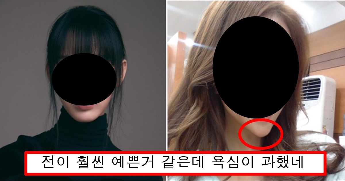 턱에 필러 너무 과하게 넣어서 징그럽다고 까이고 있는 아이돌의 정체