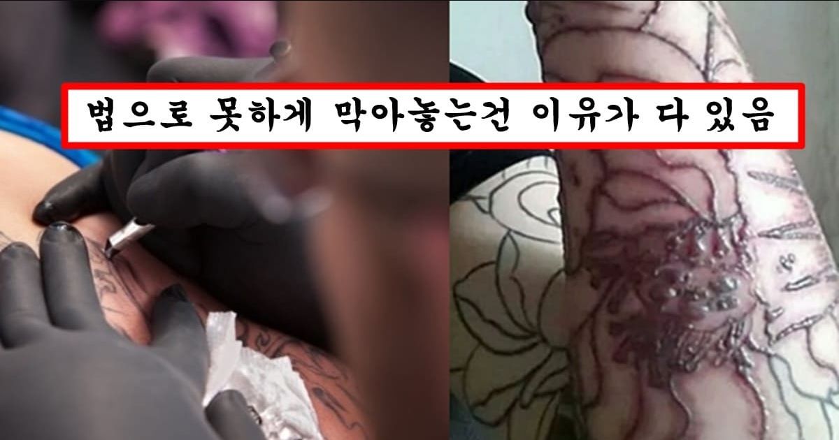 타투이스트들이 알면서 절대 말안한다는 타투하면 무조건 생긴다는 부작용 수준