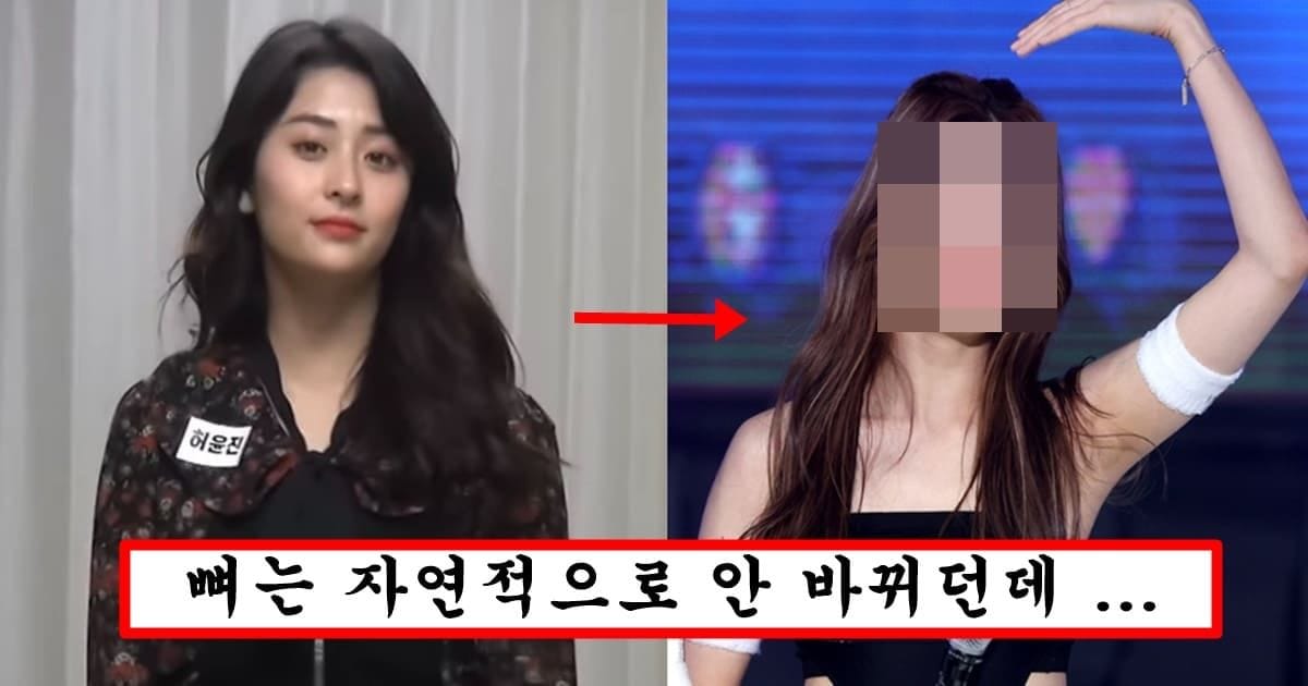 본인은 절대 수술안했다 주장하는데 광대 사각턱 다 사라진 르세라핌 맴버