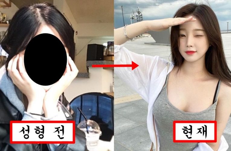 성형전 과거 사진 유출됐는데 오히려 더 좋다며 인기 떡상해버린 아프리카 여캠