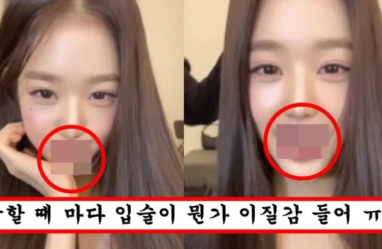 성형 안한척 혼자 다 하더니 입술필러 욕심내서 넣었다가 대참사 나버린 장원영