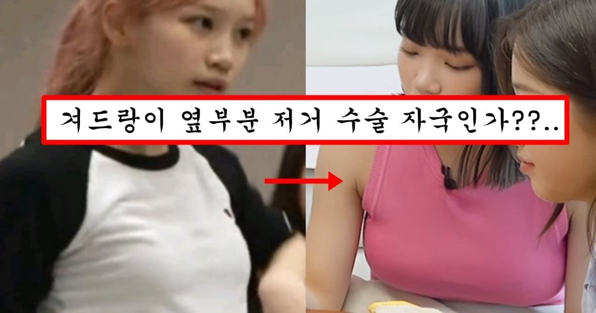 원래 트리플a였는데 갑자기 최소 g컵이 되어버린 르세라핌 김채원 근황