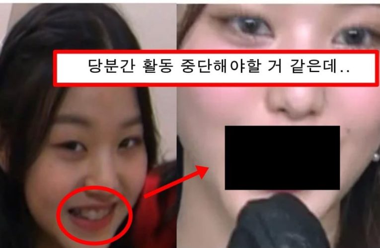 정 부작용으로 입 삐뚫어져서 활동 중단 위기까지 노였다는 장원영 심각한 상태