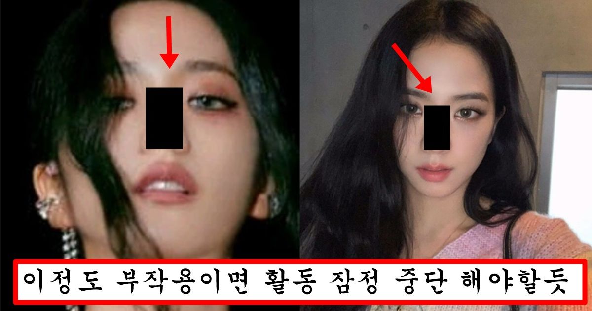 “코 수술 안하고 자연이라더니…” 코 상태 너무 심각해서 보기 싫을 정도라는 블핑 지수 코 상태