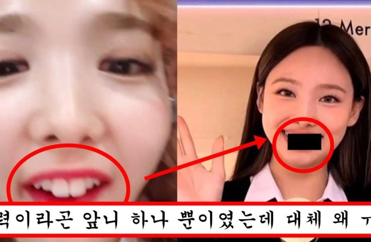 토끼 앞니 교정 하고 오히려 더 못생겨져서 탈덕 한다고 난리난 트와이스 나연