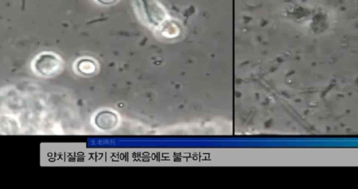 자기 직전에 양치질하는 사람들 충격적 실험 결과