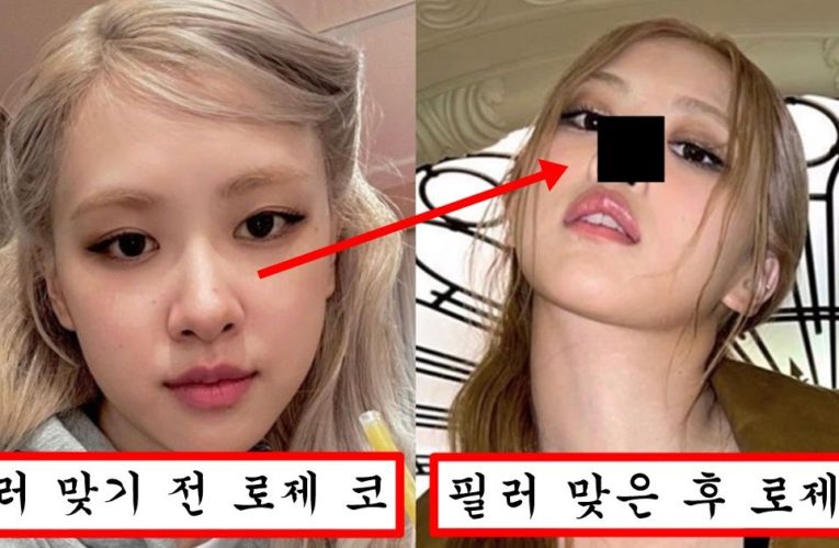 지수랑 제니 이겨보겠다고 코에 필러 심하게 넣어서 그냥 강남언니 되어버린 로제 충격 근황