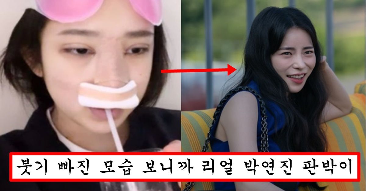 “내 꿈은 박연진” 학폭으로 나락가더니 박연진과 똑같이 성형하겠다고 인스타에 성형 사진 인증한 최진실 딸