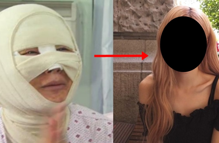 못 생겼다며 남편한테 무시 당하던 여자가 성형하고 당한 충격적인 일