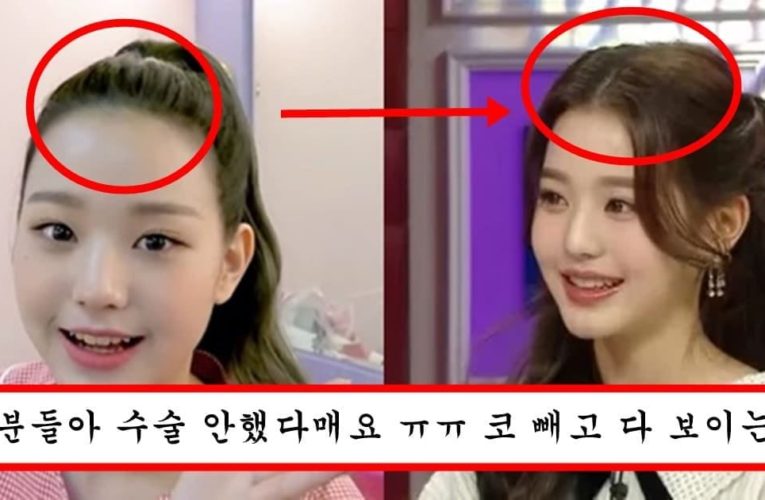 성형 1도 안한척 하면서 헤어라인까지 의심된다는 장원영 충격 과거 이마
