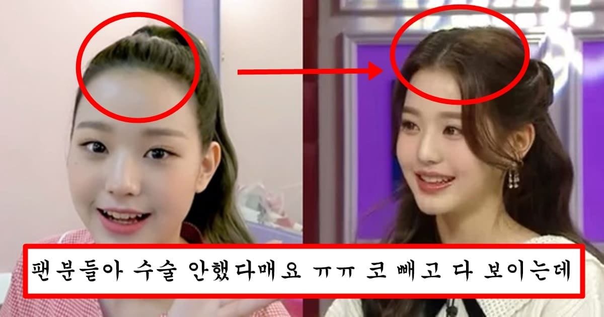 성형 1도 안한척 하면서 헤어라인까지 의심된다는 장원영 충격 과거 이마