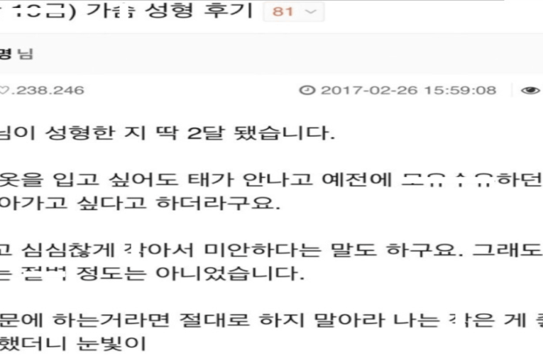 마눌님의 미드 수술 후기